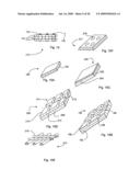 Bioerodible self-deployable intragastric implants diagram and image