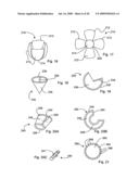 Bioerodible self-deployable intragastric implants diagram and image