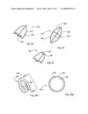 Bioerodible self-deployable intragastric implants diagram and image