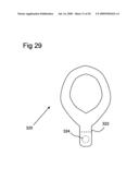 Bioerodible self-deployable intragastric implants diagram and image