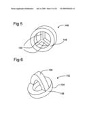 Bioerodible self-deployable intragastric implants diagram and image