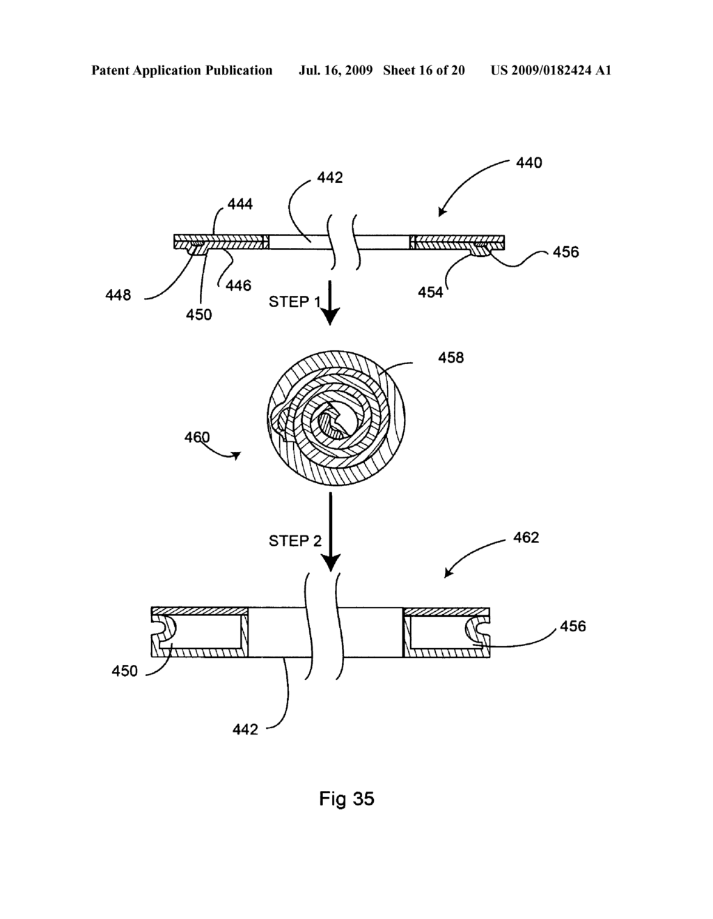 Bioerodible self-deployable intragastric implants - diagram, schematic, and image 17