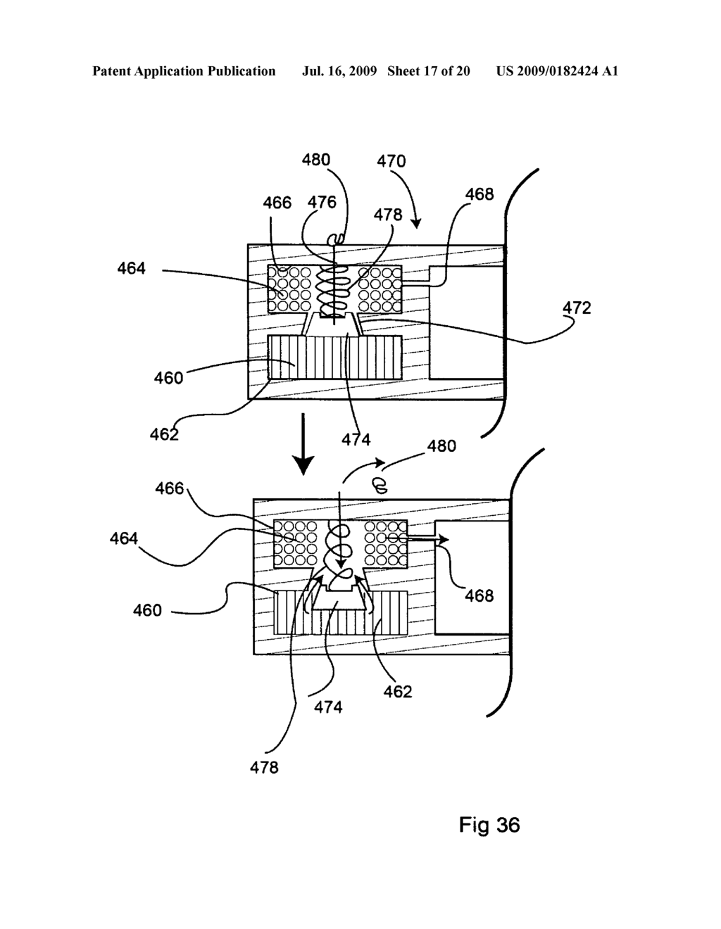 Bioerodible self-deployable intragastric implants - diagram, schematic, and image 18