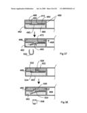 Bioerodible self-deployable intragastric implants diagram and image