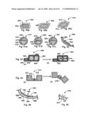 Bioerodible self-deployable intragastric implants diagram and image