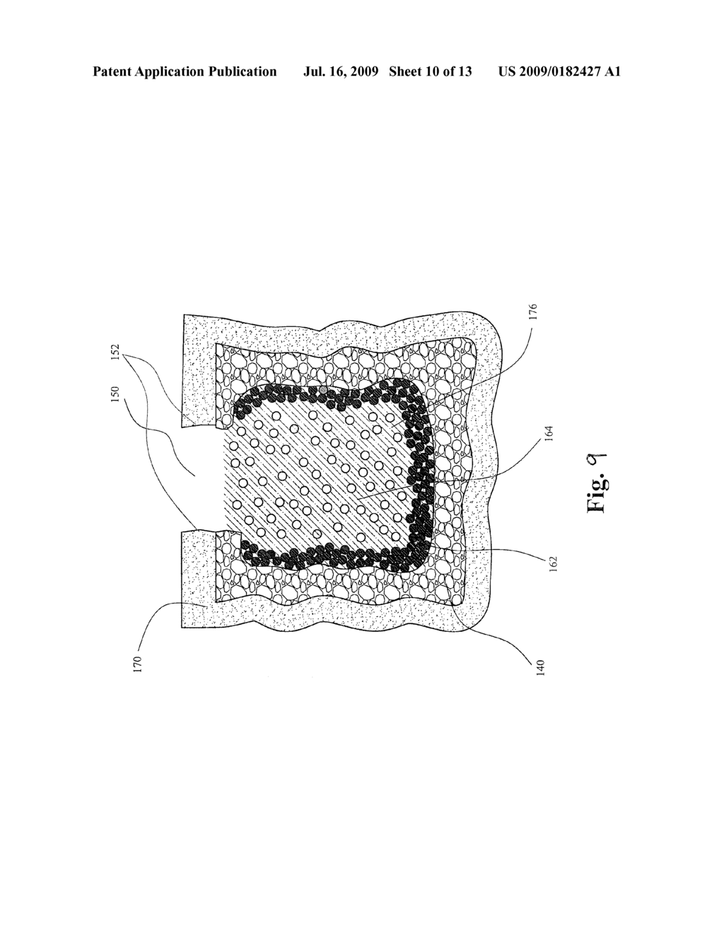 VERTEBROPLASTY IMPLANT WITH ENHANCED INTERFACIAL SHEAR STRENGTH - diagram, schematic, and image 11