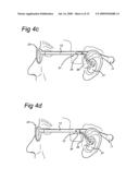 Connector assembly for connecting an earpiece of a hearing aid to glasses temple diagram and image