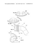 METHODS AND DEVICES FOR IMPROVING EFFICACY OF NON-INVASIVE VENTILATION diagram and image