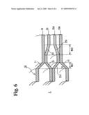 Metal gasket diagram and image