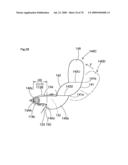 Knee protecting airbag device diagram and image