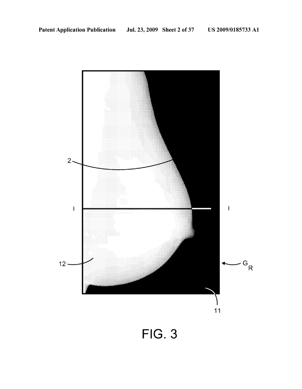 Method and Apparatus for Processing Digital Mammographic Images - diagram, schematic, and image 03