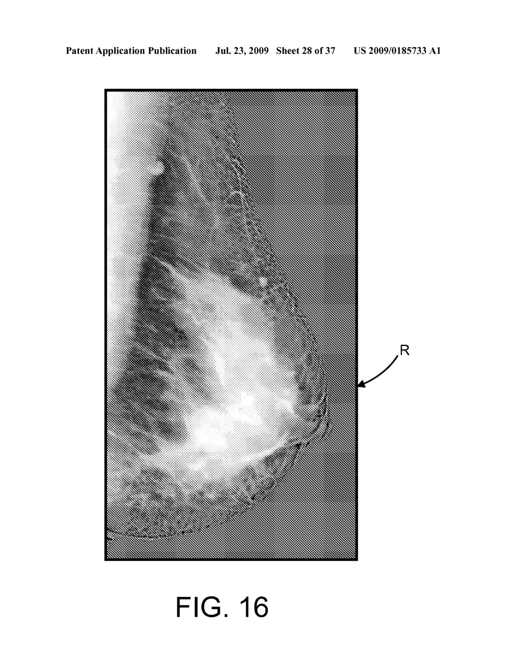 Method and Apparatus for Processing Digital Mammographic Images - diagram, schematic, and image 29