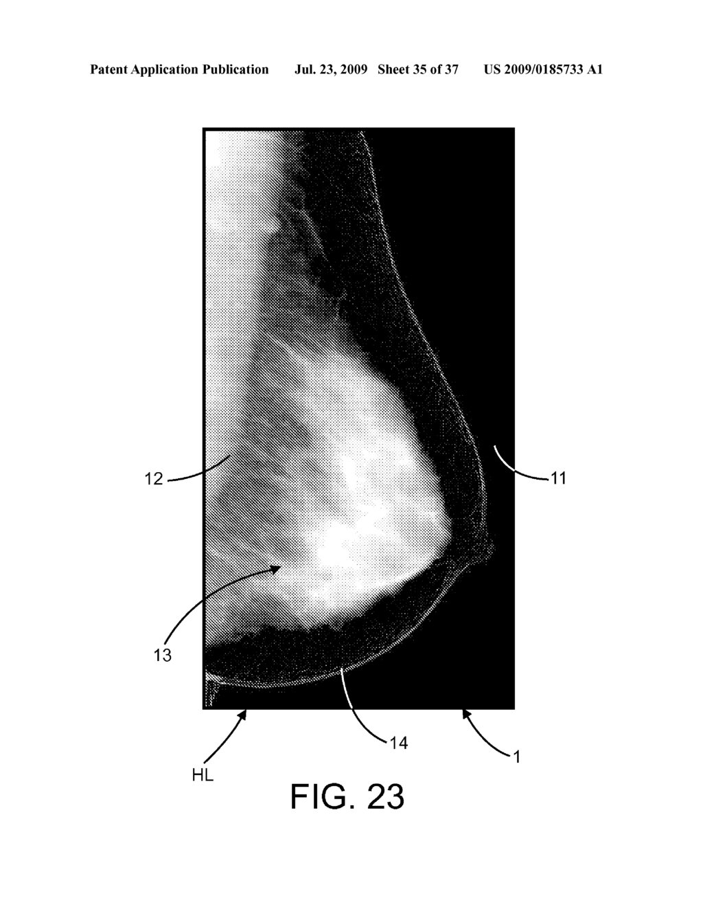 Method and Apparatus for Processing Digital Mammographic Images - diagram, schematic, and image 36