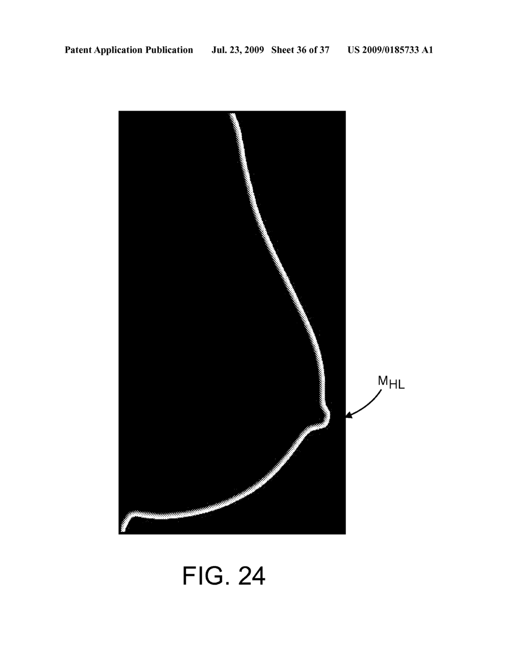 Method and Apparatus for Processing Digital Mammographic Images - diagram, schematic, and image 37