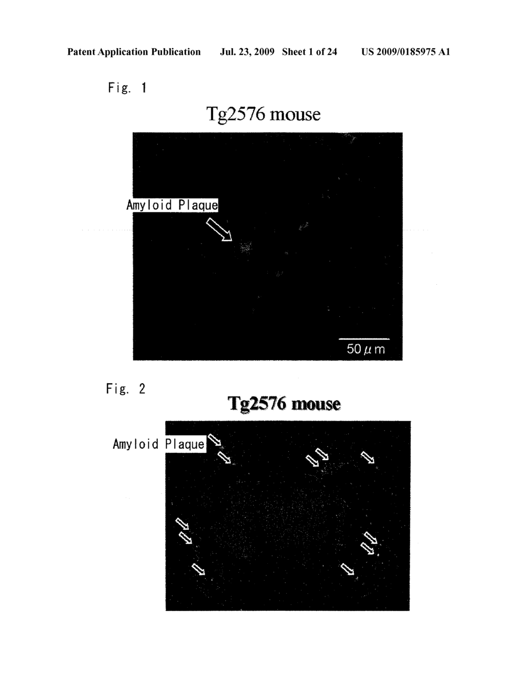 DIAGNOSTIC PROBE FOR CONFORMATION DISEASE - diagram, schematic, and image 02