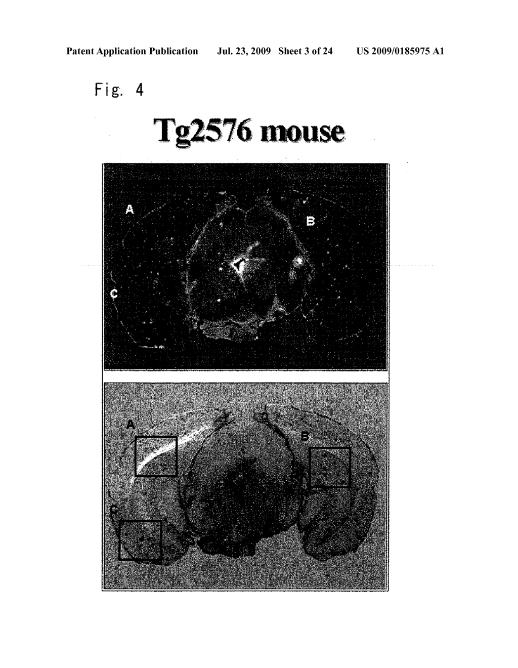 DIAGNOSTIC PROBE FOR CONFORMATION DISEASE - diagram, schematic, and image 04