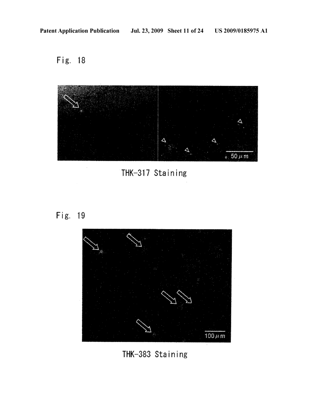 DIAGNOSTIC PROBE FOR CONFORMATION DISEASE - diagram, schematic, and image 12