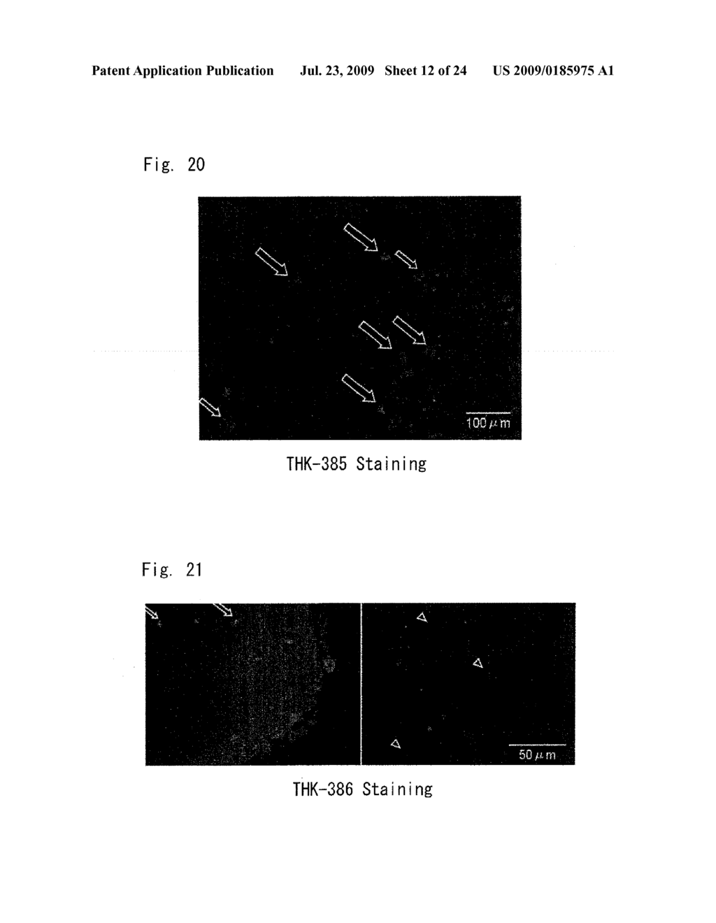 DIAGNOSTIC PROBE FOR CONFORMATION DISEASE - diagram, schematic, and image 13