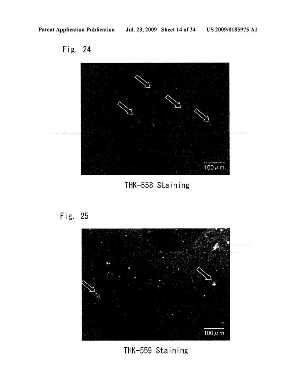 DIAGNOSTIC PROBE FOR CONFORMATION DISEASE - diagram, schematic, and image 15