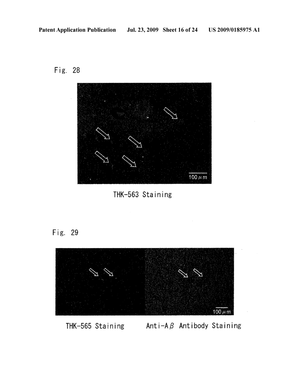 DIAGNOSTIC PROBE FOR CONFORMATION DISEASE - diagram, schematic, and image 17