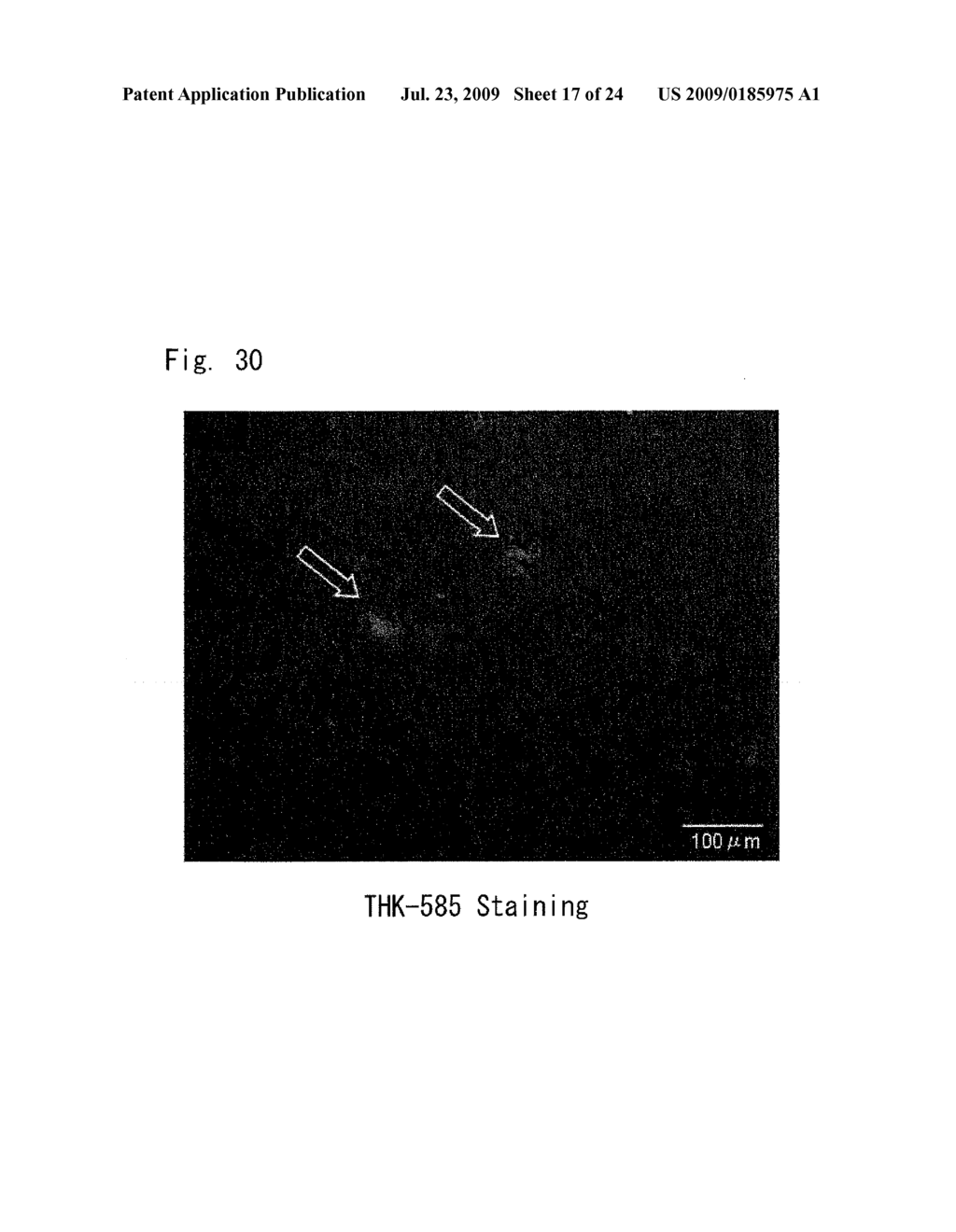 DIAGNOSTIC PROBE FOR CONFORMATION DISEASE - diagram, schematic, and image 18