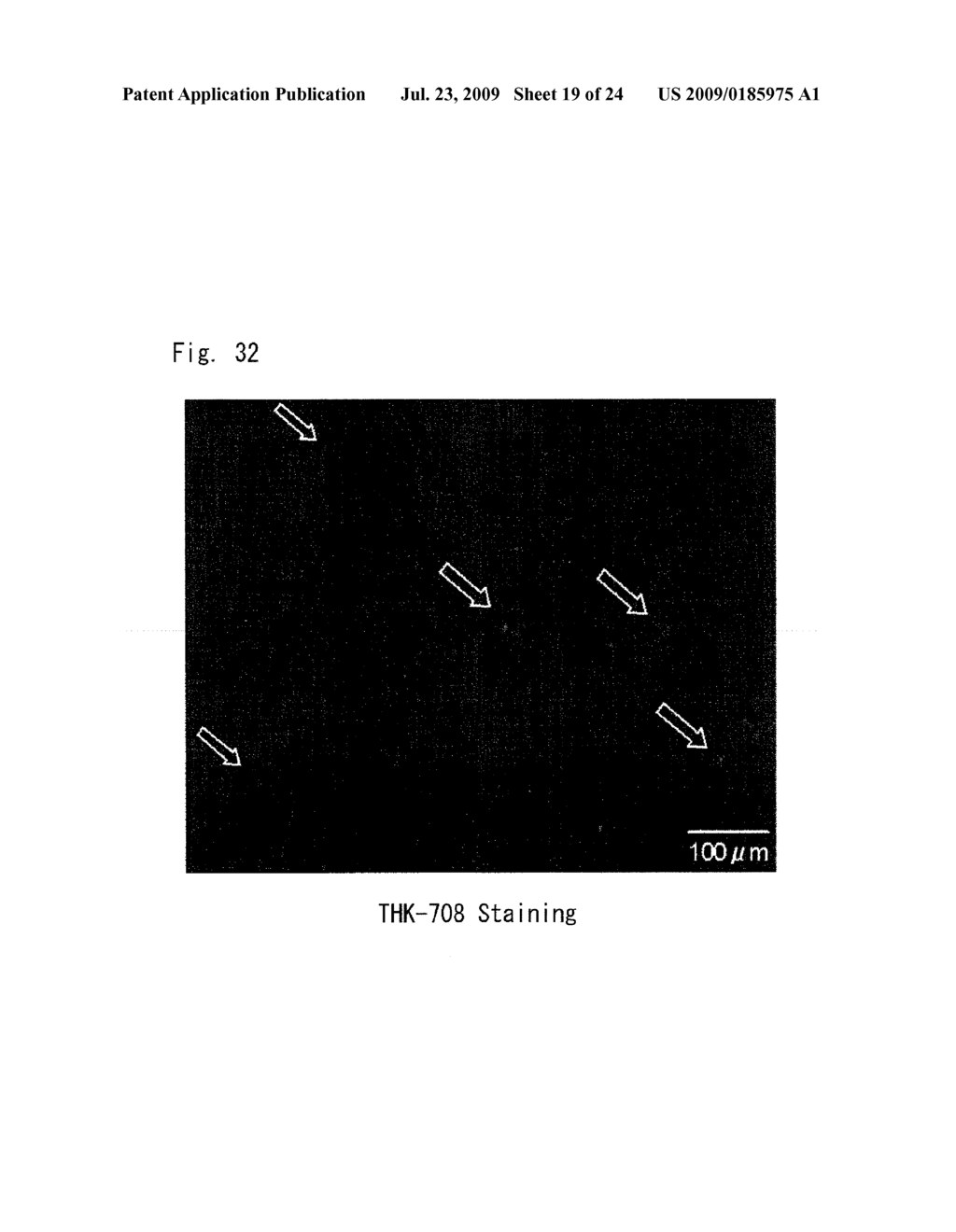 DIAGNOSTIC PROBE FOR CONFORMATION DISEASE - diagram, schematic, and image 20