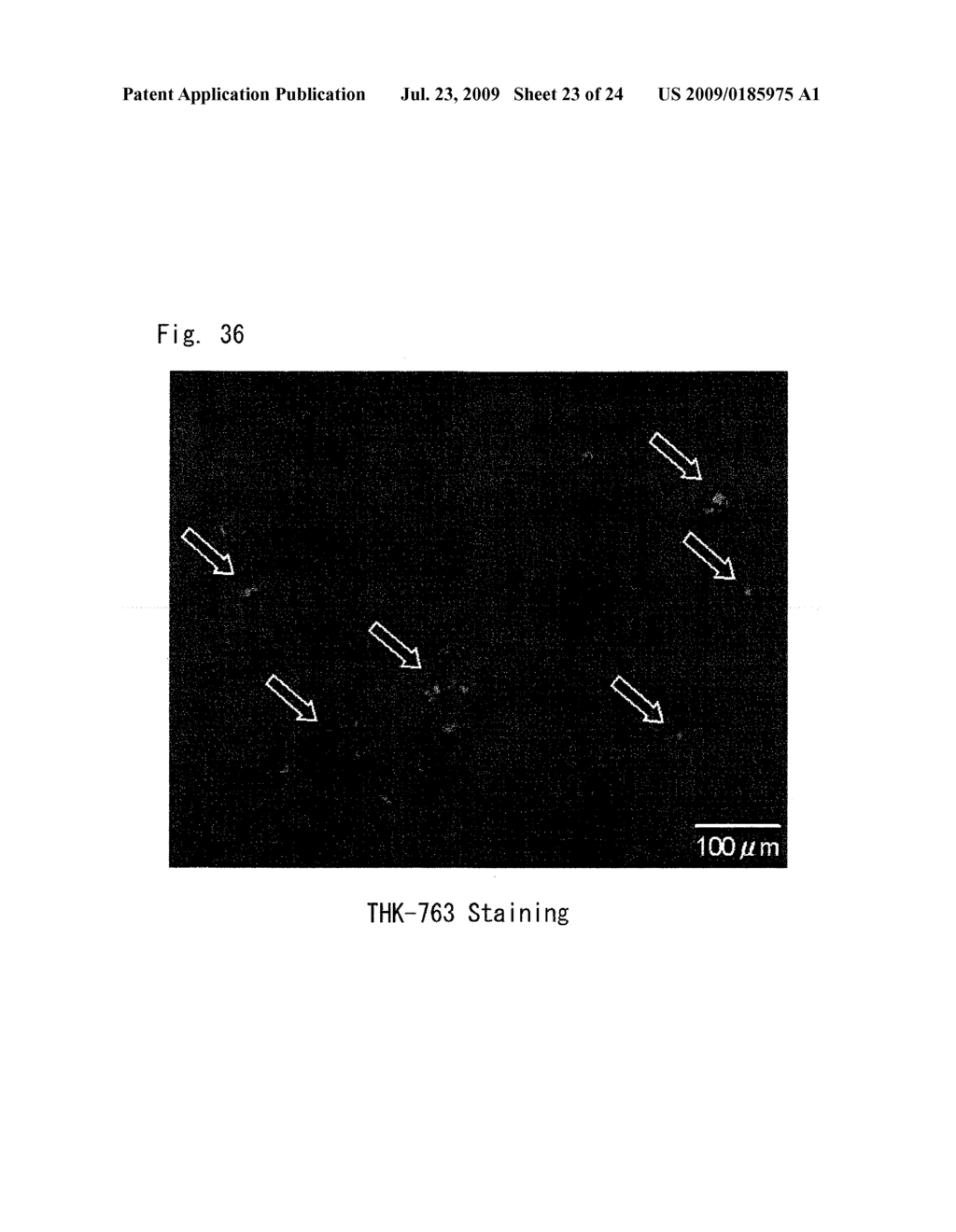 DIAGNOSTIC PROBE FOR CONFORMATION DISEASE - diagram, schematic, and image 24