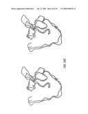 Antibodies that specifically bind hedgehog-derived polypeptides diagram and image