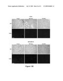 Methods of Inhibiting Tumor Cell Aggressiveness Using The Microenvironment of Human Embryonic Stem Cells diagram and image