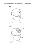 Fixture of the Head for Transcranial Magnetic Stimulation and Transcranial Magnetic Stimulator diagram and image