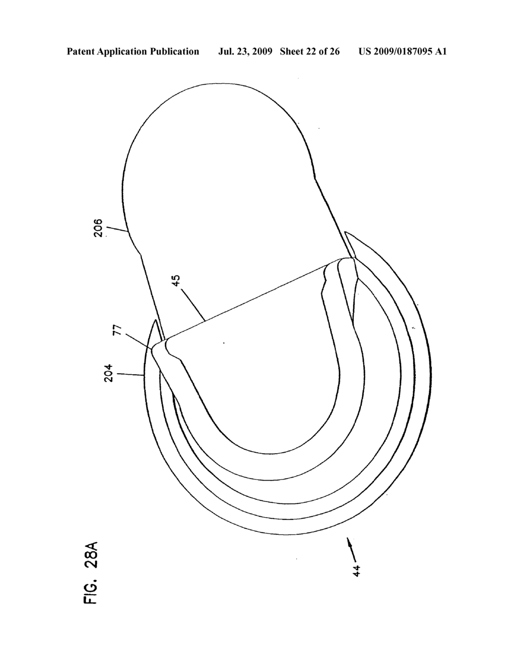 Analyte Monitoring Device and Methods of Use - diagram, schematic, and image 23