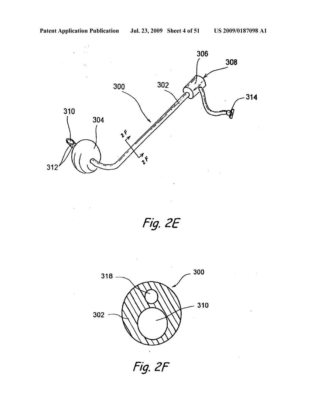 Devices, Systems and Methods for Diagnosing and Treating Sinusitis and Other Disorders of the Ears, Nose, and/or Throat - diagram, schematic, and image 05