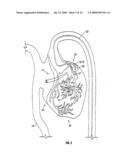 METHOD AND APPARATUS TO REMOVE SUBSTANCES FROM VESSELS OF THE HEART AND OTHER PARTS OF THE BODY TO MINIMIZE OR AVOID RENAL OR OTHER HARM OR DYSFUNCTION diagram and image