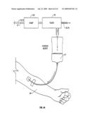 METHOD AND APPARATUS TO REMOVE SUBSTANCES FROM VESSELS OF THE HEART AND OTHER PARTS OF THE BODY TO MINIMIZE OR AVOID RENAL OR OTHER HARM OR DYSFUNCTION diagram and image