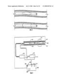 METHOD AND APPARATUS TO REMOVE SUBSTANCES FROM VESSELS OF THE HEART AND OTHER PARTS OF THE BODY TO MINIMIZE OR AVOID RENAL OR OTHER HARM OR DYSFUNCTION diagram and image