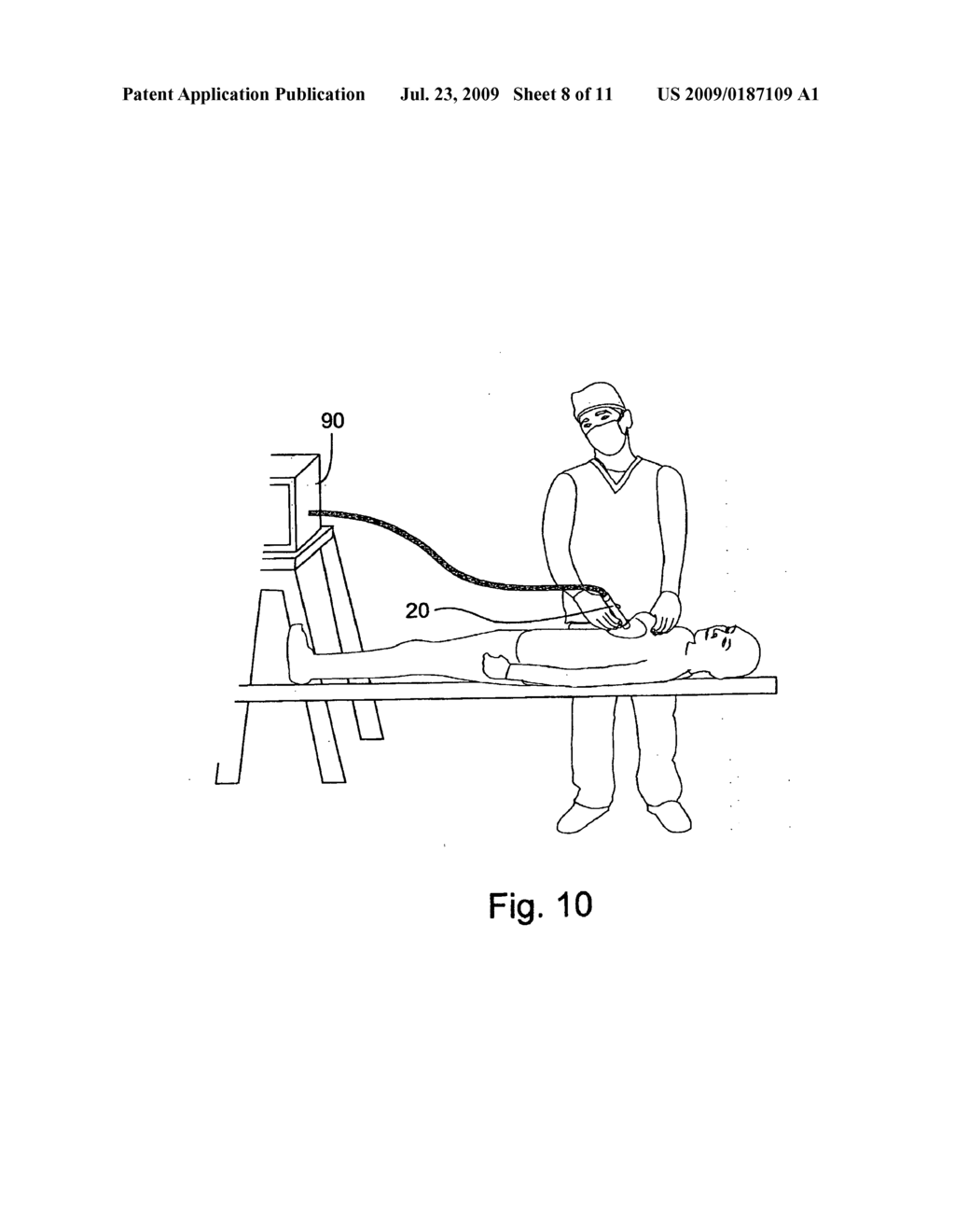 METHOD AND APPARATUS FOR EXAMINING TISSUE FOR PREDEFINED TARGET CELLS, PARTICULARLY CANCEROUS CELLS, AND A PROBE USEFUL IN SUCH METHOD AND APPARATUS - diagram, schematic, and image 09