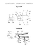 Multiple Needle System diagram and image