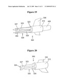 Multiple Needle System diagram and image