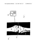 IMPLANTABLE SENSOR AND ASSOCIATED METHODS diagram and image