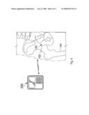 IMPLANTABLE SENSOR AND ASSOCIATED METHODS diagram and image