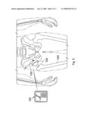 IMPLANTABLE SENSOR AND ASSOCIATED METHODS diagram and image