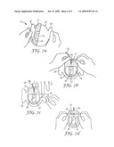 HYDROGELS WITH TAPERED EDGE diagram and image