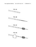 METHODS AND DEVICES FOR RETRIEVAL OF A MEDICAL AGENT FROM A PHYSIOLOGICAL EFFERENT FLUID COLLECTION SITE diagram and image