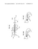 METHODS AND DEVICES FOR RETRIEVAL OF A MEDICAL AGENT FROM A PHYSIOLOGICAL EFFERENT FLUID COLLECTION SITE diagram and image