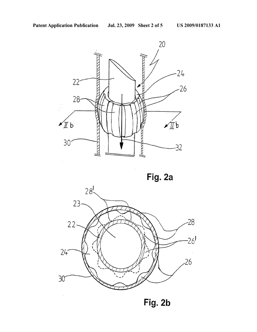 APPLIANCE FOR CANNULATION OF A BLOOD VESSEL - diagram, schematic, and image 03