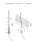 Flow elements for use with flexible spinal needles, needle assemblies and methods therefor diagram and image