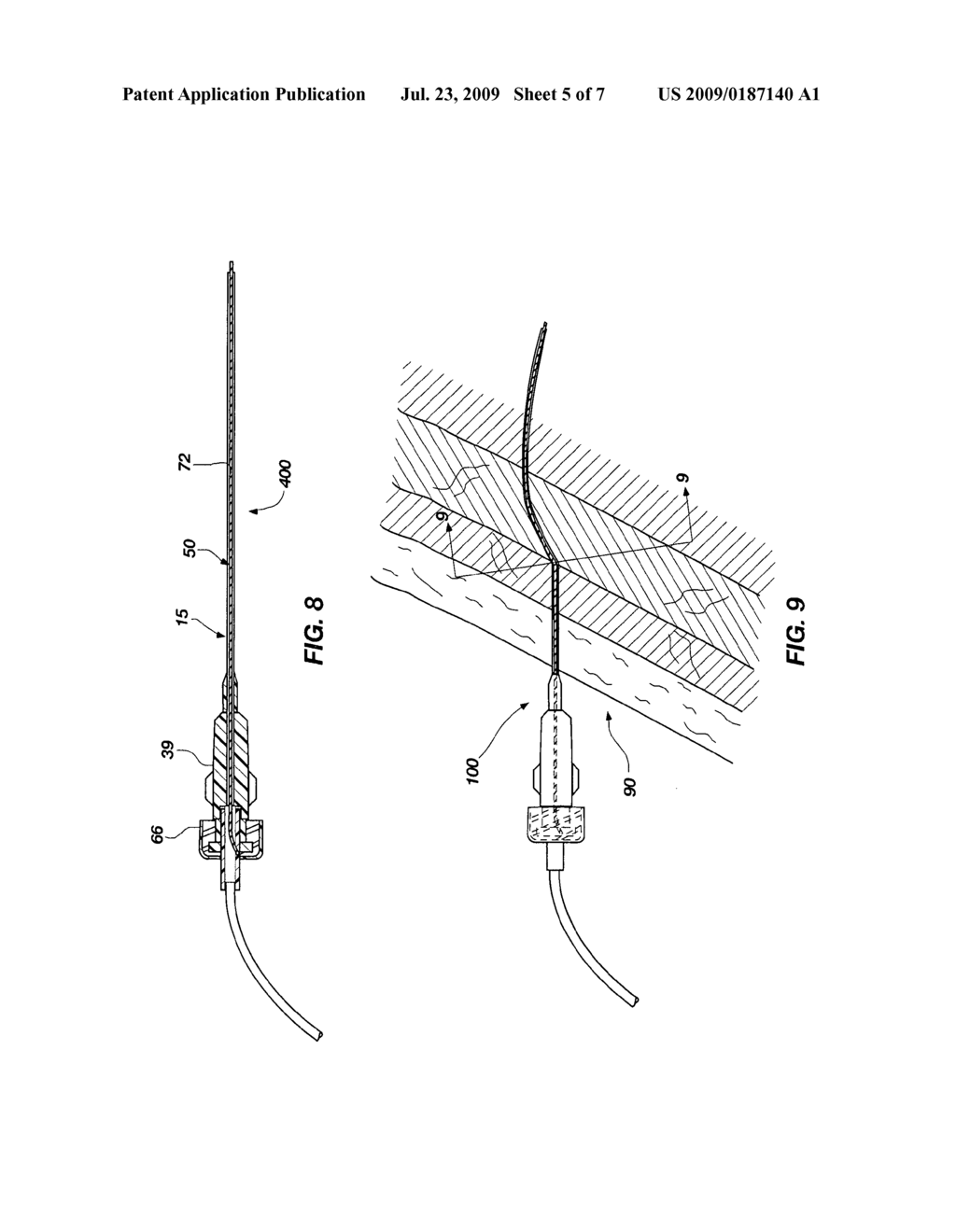 Flow elements for use with flexible spinal needles, needle assemblies and methods therefor - diagram, schematic, and image 06