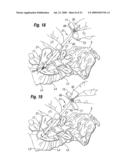 One step entry pedicular preparation device and disc access system diagram and image