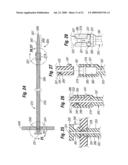 One step entry pedicular preparation device and disc access system diagram and image