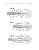 One step entry pedicular preparation device and disc access system diagram and image